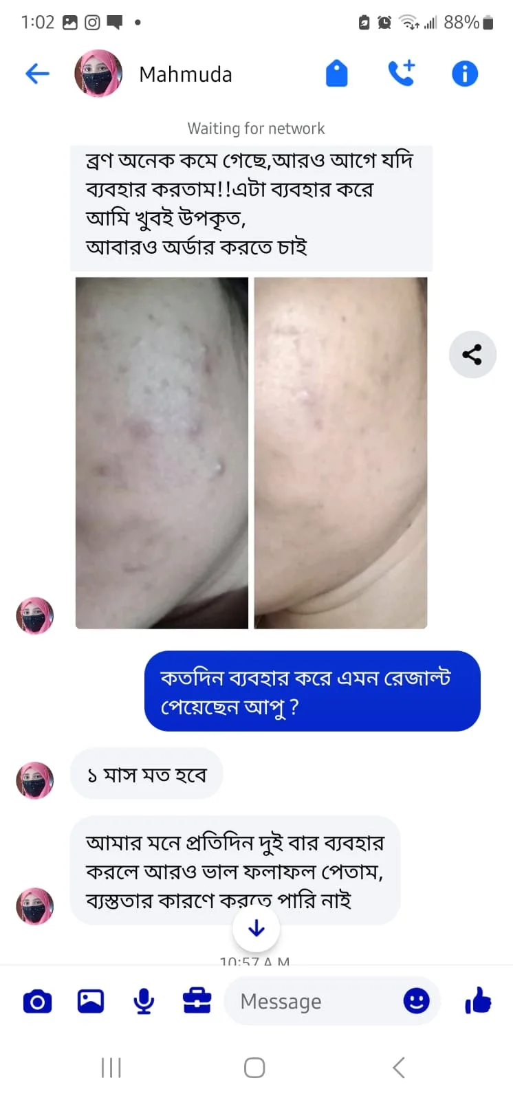 Pimple Reduced